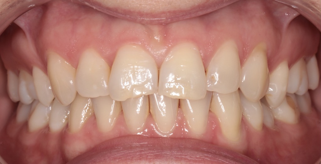 Konsultacja Ortodontyczna - zdjęcie zębów