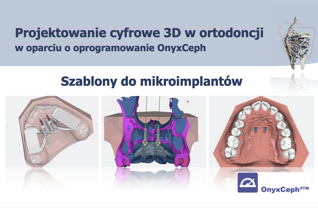 OnyxCeph – Szablony do mikroimplantów